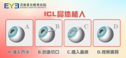 青海爱尔：ICL晶体植入怎么样呢，我们来了解一